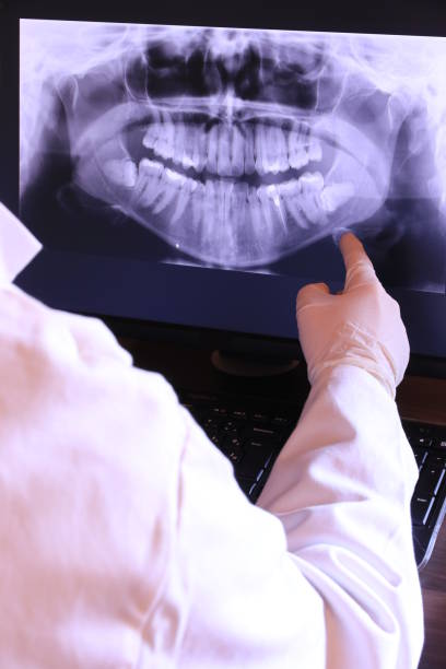 Best Broken or Chipped Tooth Repair in Rosend, LA