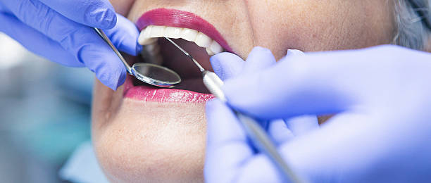 Best Emergency Dental Care for Sports Injuries in Rosend, LA